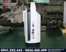 https://hueloimedtech.com/image/cache/catalog/v1/1-thiet-bi-thu-y/may-sieu-am-thu-y/may-sieu-am-doppler-mau-thu-y-c50v/may-sieu-am-di-dong-c50-copy-250x200.jpg