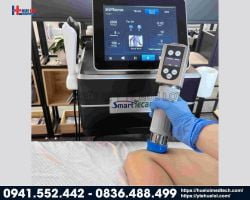 https://hueloimedtech.com/image/cache/catalog/v1/1-thiet-bi-y-te/thiet-bi-vat-ly-tri-lieu/tecar/k-smart-wave/may-tan-so-vo-tuyen-tri-lieu-250x200.jpg