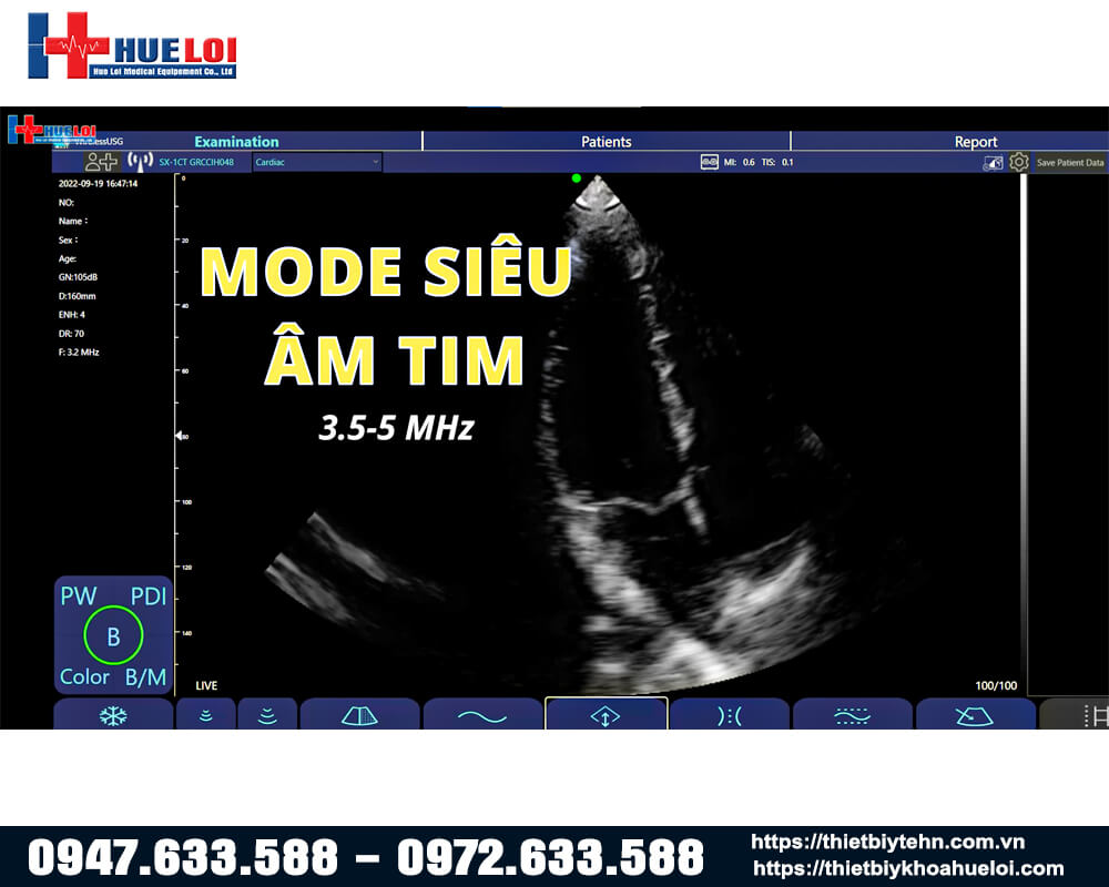 Siêu âm tim trong dải tần số 3.5-5Mhz