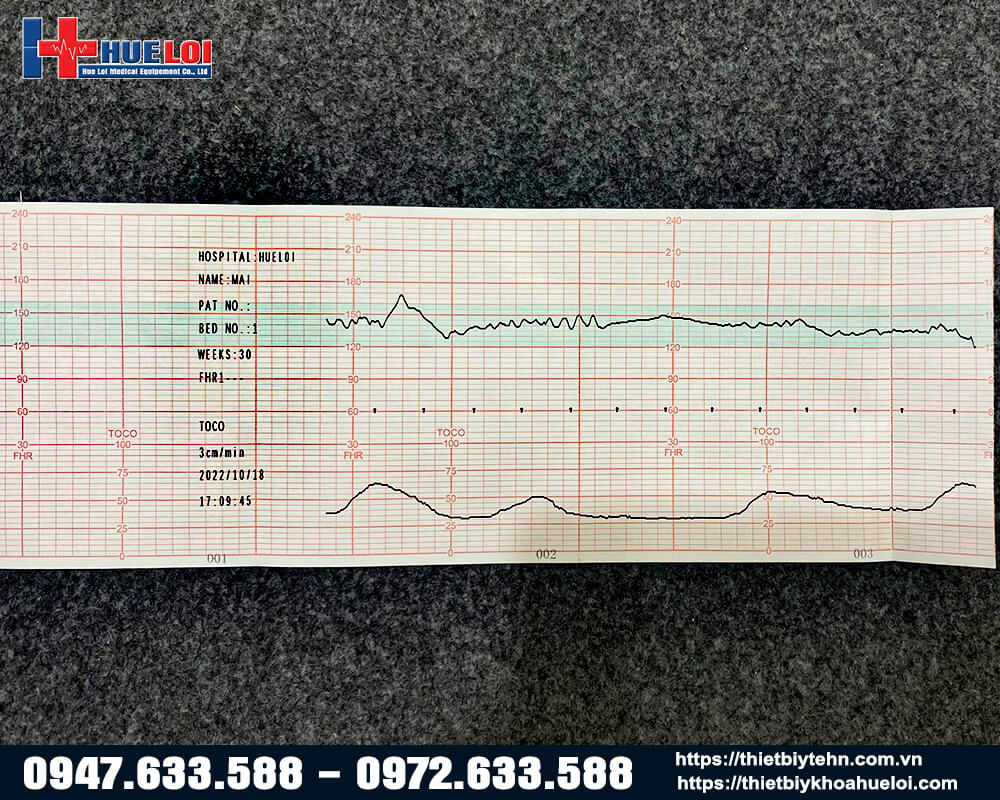 Phiếu kết quả sau khi đo và in của máy cms 800g