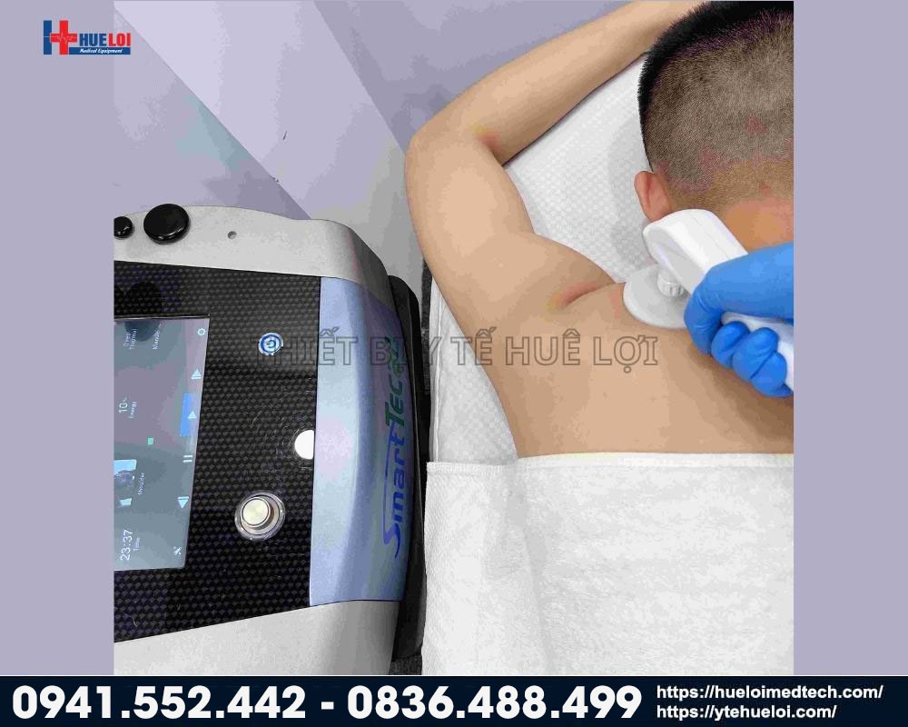 trị liệu bằng đầu RET cho máy trị liệu sóng vô tuyến