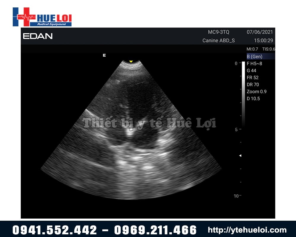 hình ảnh thực tế kết quả 2d của máy siêu âm edan ax2 vet